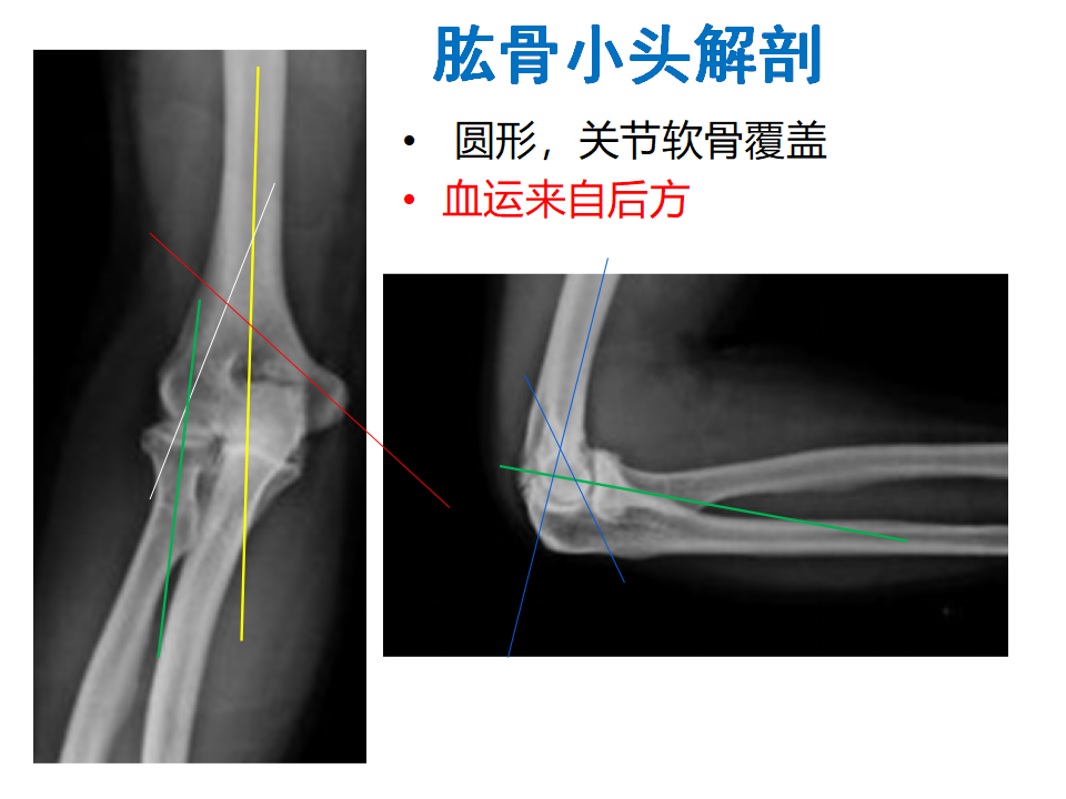 肱骨小头骨折临床治疗与手术技巧