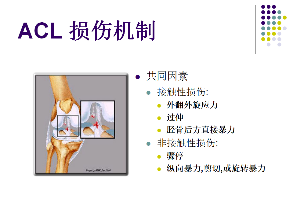 膝关节前交叉韧带损伤诊断与治疗