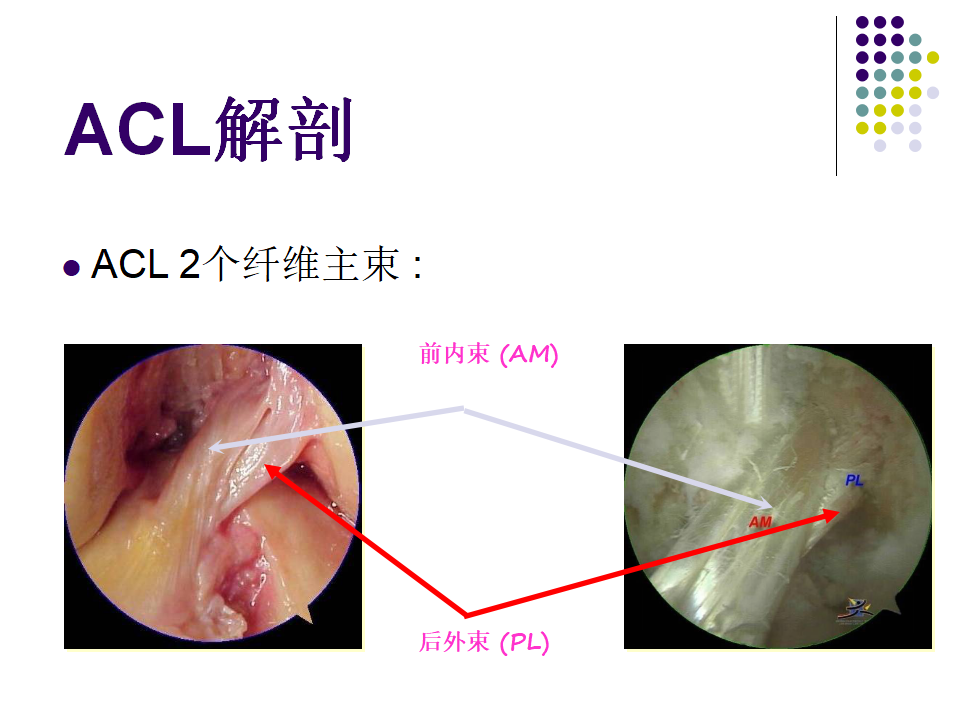 膝关节前交叉韧带损伤诊断与治疗