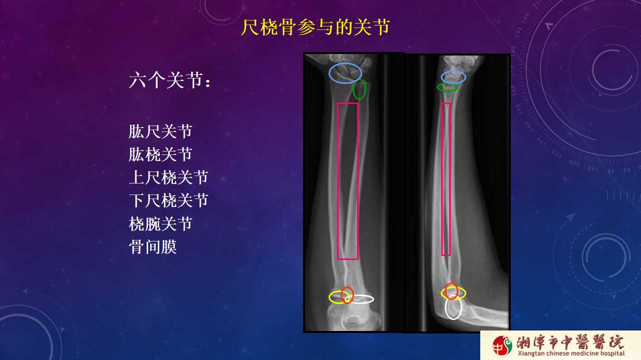 杨氏旋后牵引法治疗尺桡骨骨折