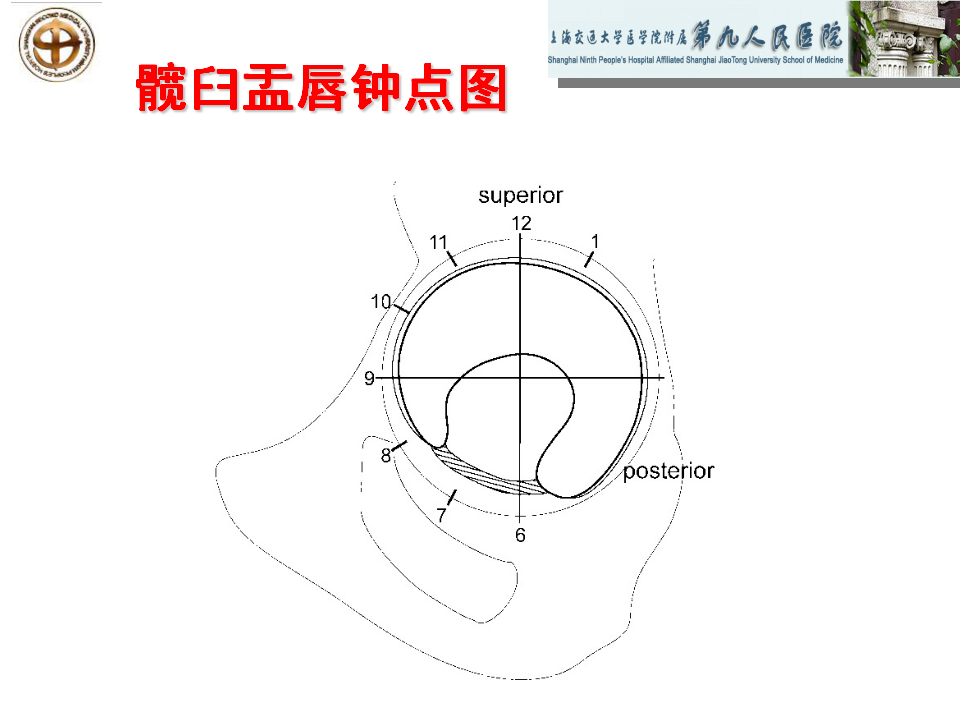 如何做好成人髋关节影像学诊断？