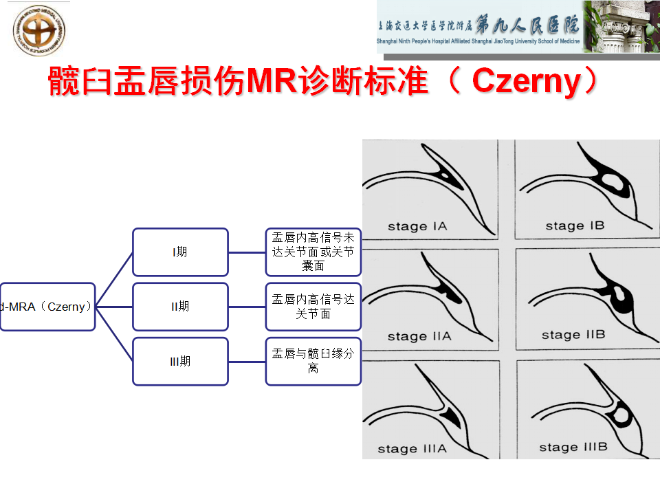 如何做好成人髋关节影像学诊断？