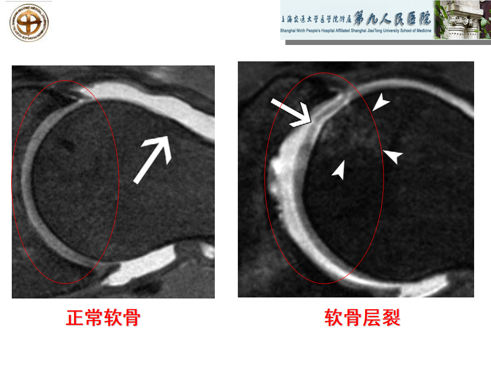 如何做好成人髋关节影像学诊断？