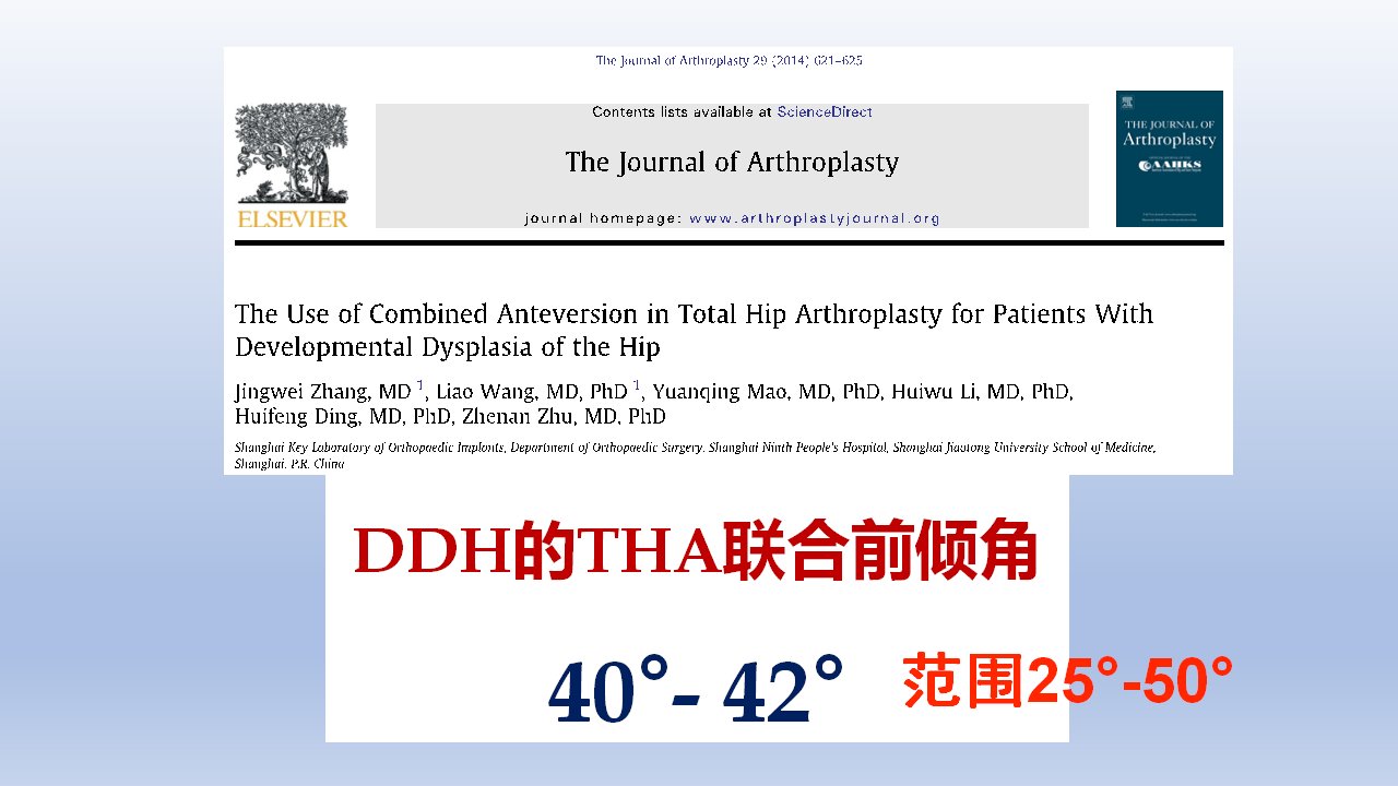 DDH全髋关节置换手术难点及对策