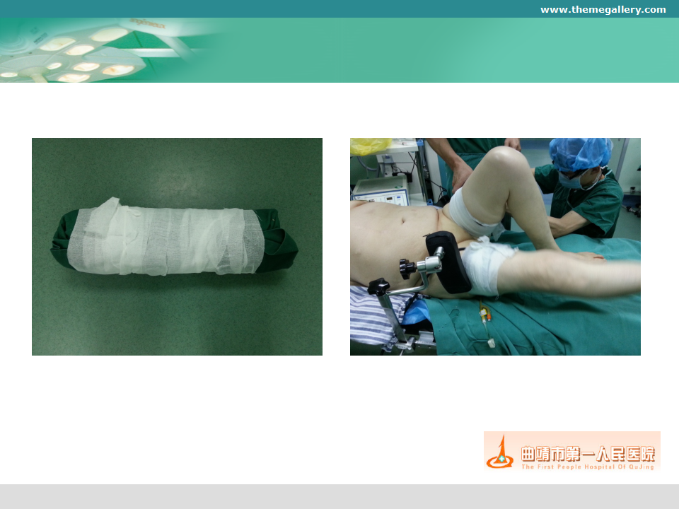 初次膝关节置换术的手术要点及技巧