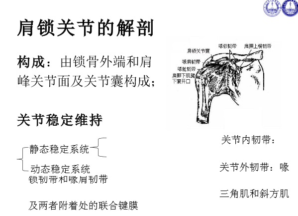 肩锁关节脱位的诊断与治疗