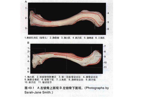 肩锁关节脱位的诊断与治疗