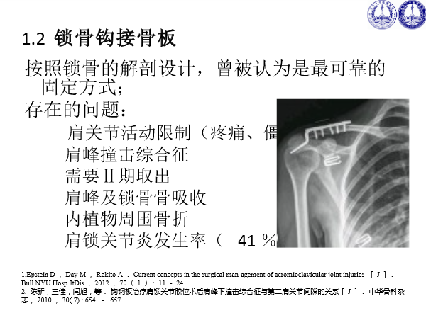 肩锁关节脱位的诊断与治疗