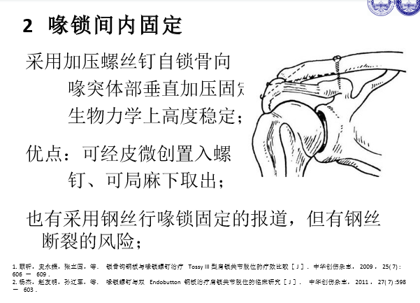 肩锁关节脱位的诊断与治疗