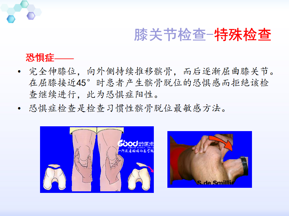 膝关节体格检查怎么做？看完这篇就知道了！