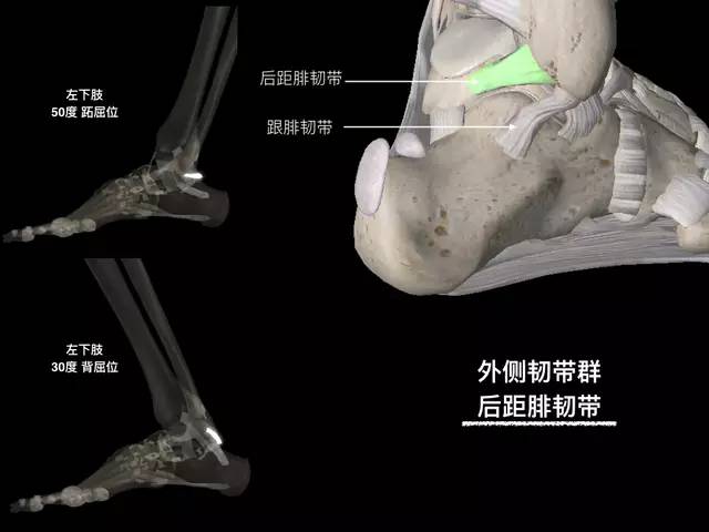 踝关节韧带解剖高清图解，值得收藏！