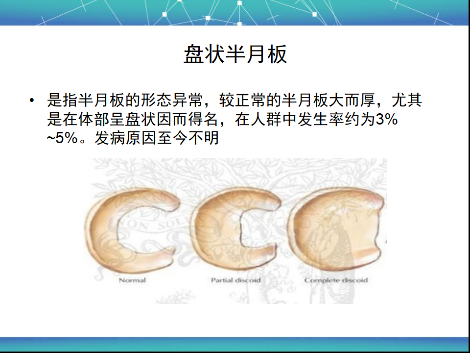 膝关节半月板MRI诊断，看这篇就够了！