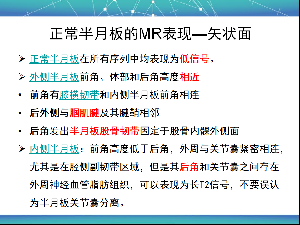 膝关节半月板MRI诊断，看这篇就够了！