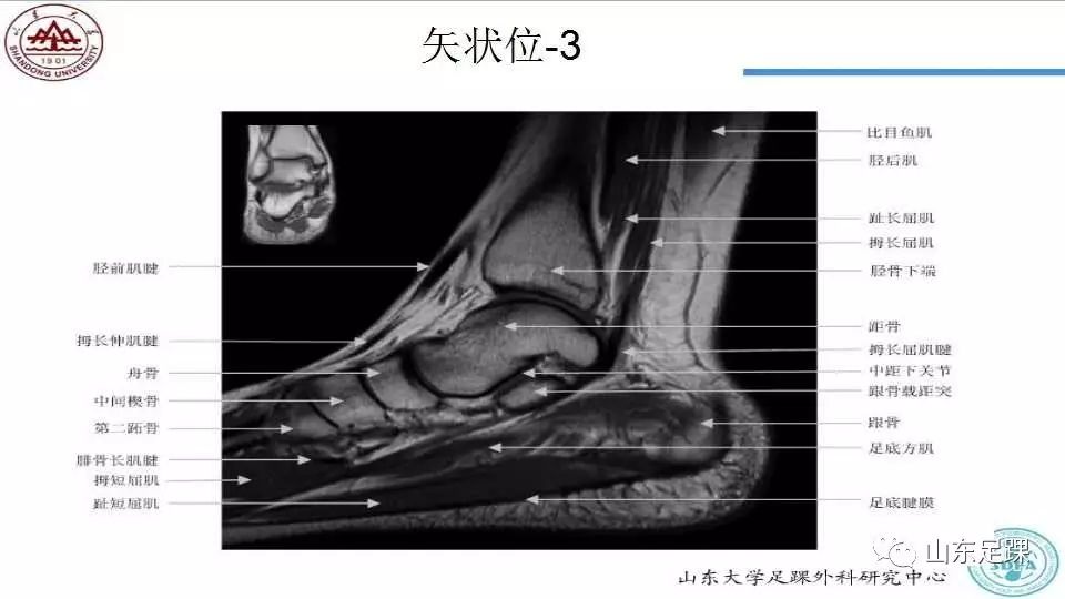 踝关节MRI的断层解剖，值得收藏备用！