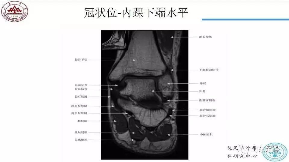 踝关节MRI的断层解剖，值得收藏备用！