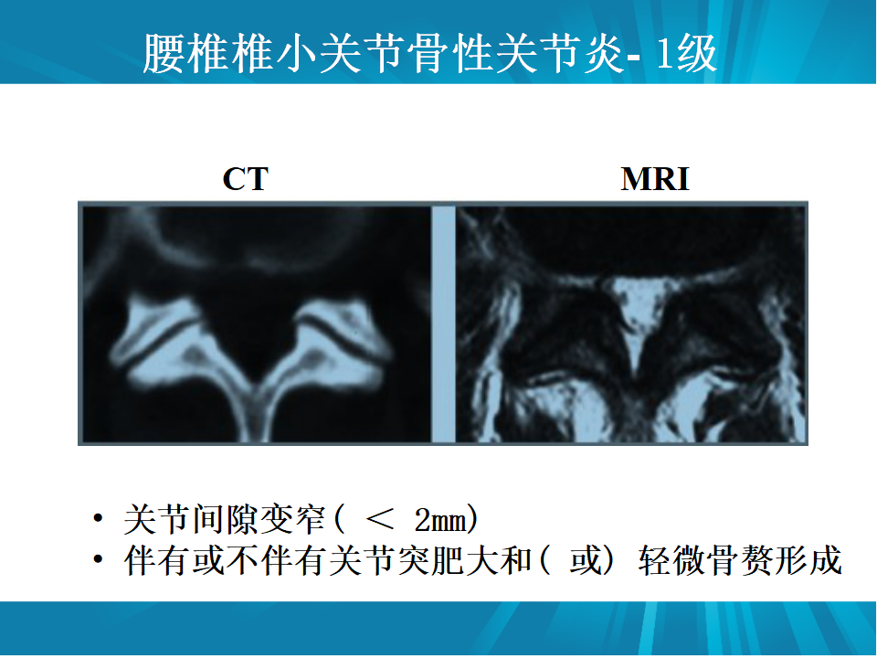 脊柱常见疾病的MRI诊断技巧，都在这篇课件里！