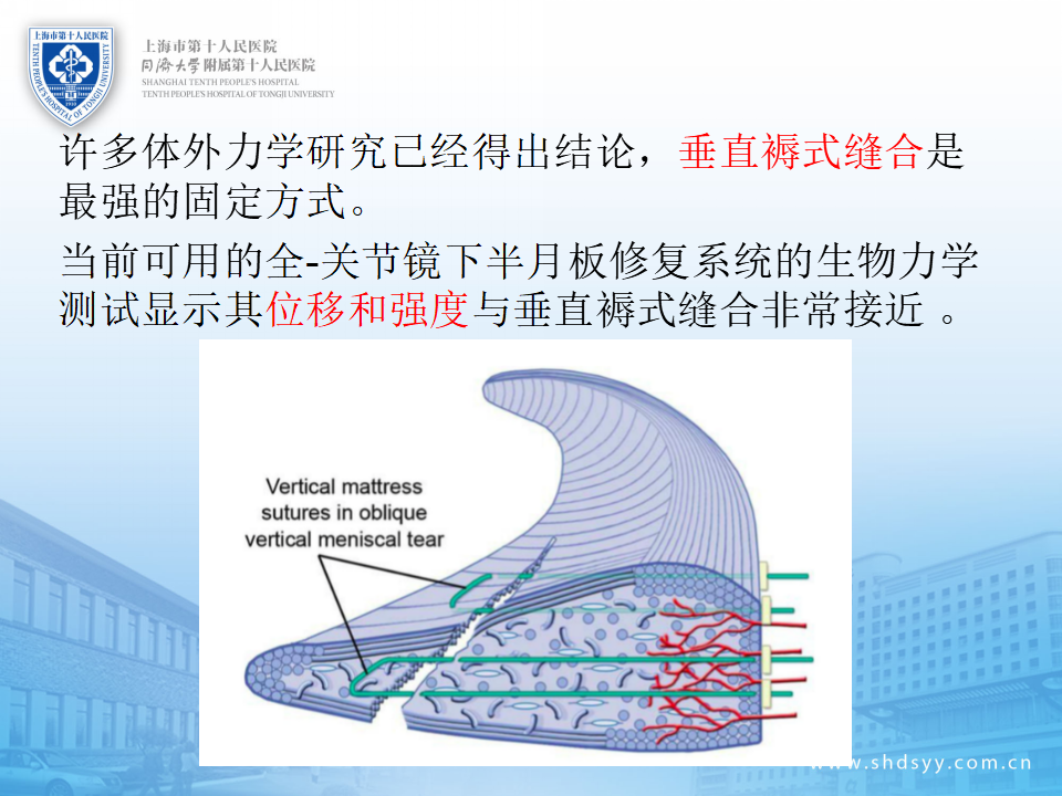 半月板损伤的诊治技巧，看完这篇就够了！