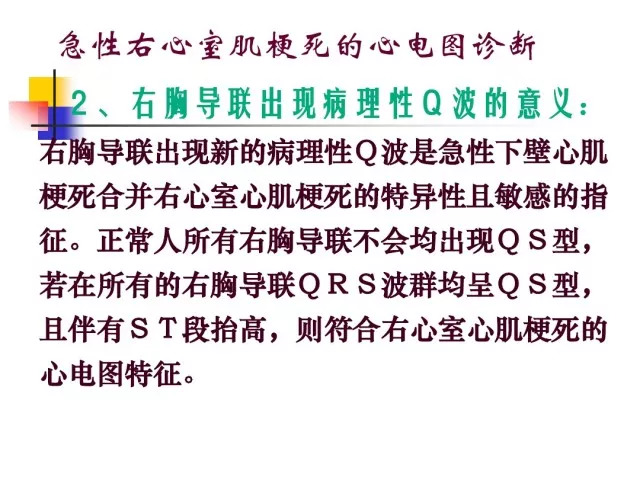 急性心肌梗死的识别