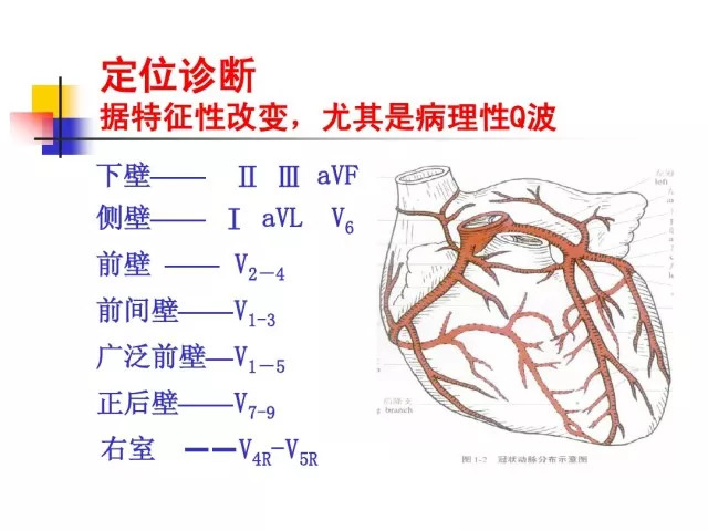 急性心肌梗死的识别