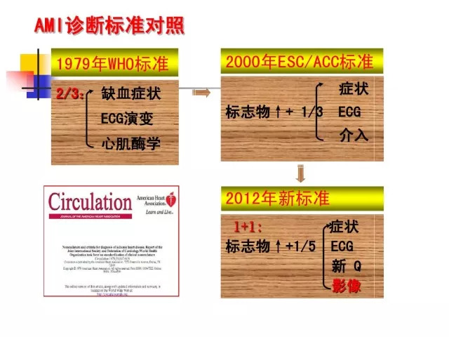 急性心肌梗死的识别