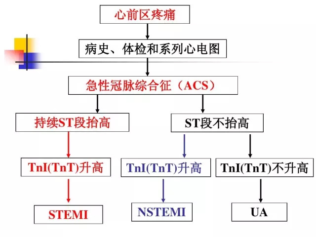 急性心肌梗死的识别