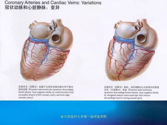 急性心肌梗死的心电图演变