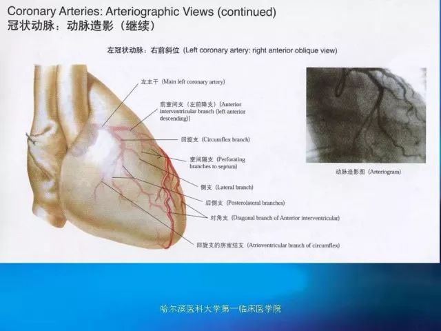 急性心肌梗死的心电图演变