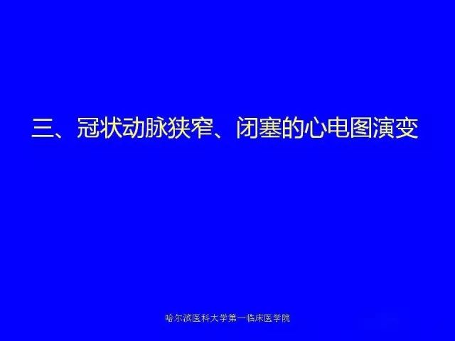 急性心肌梗死的心电图演变