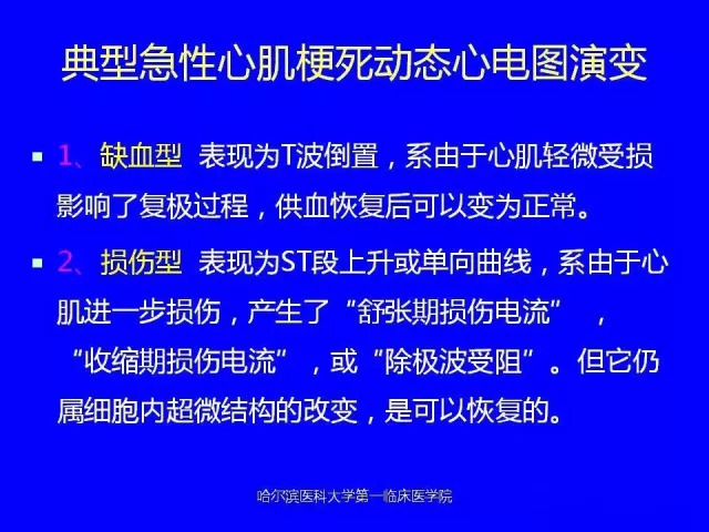 急性心肌梗死的心电图演变