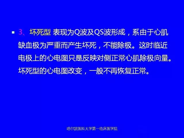 急性心肌梗死的心电图演变