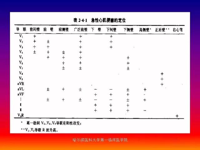 急性心肌梗死的心电图演变