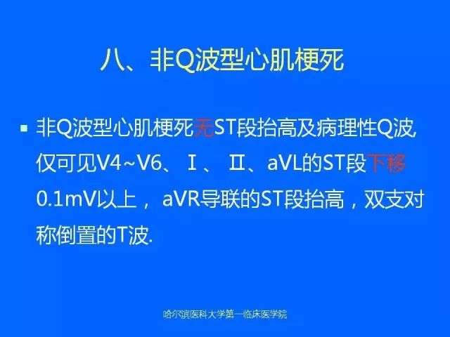 急性心肌梗死的心电图演变