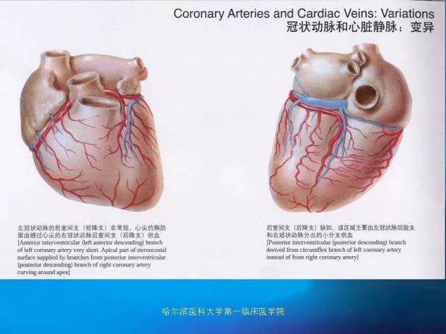 急性心肌梗死的心电图演变