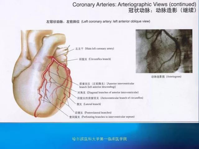 急性心肌梗死的心电图演变