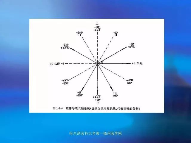 急性心肌梗死的心电图演变