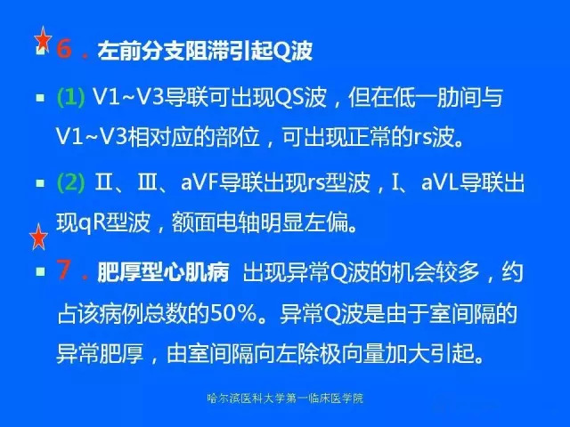 急性心肌梗死的心电图演变