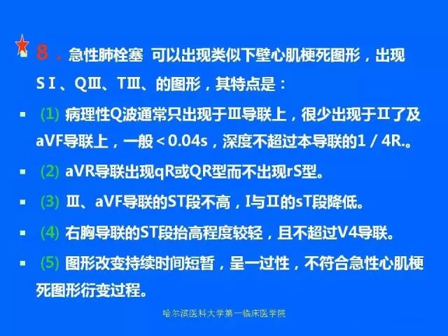 急性心肌梗死的心电图演变