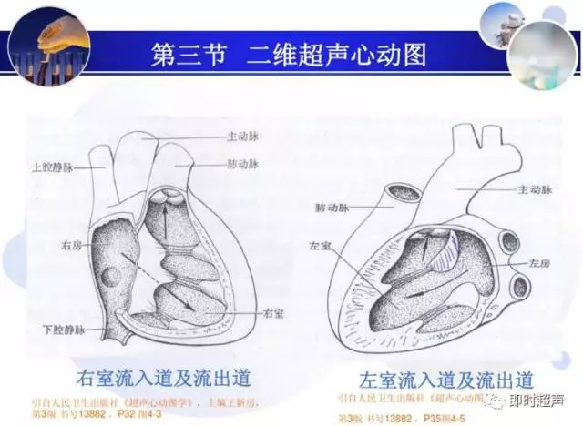 正常心脏超声诊断