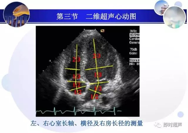 正常心脏超声诊断