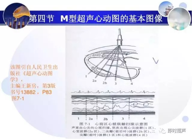 正常心脏超声诊断