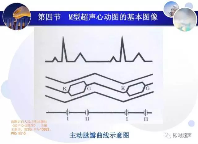 正常心脏超声诊断