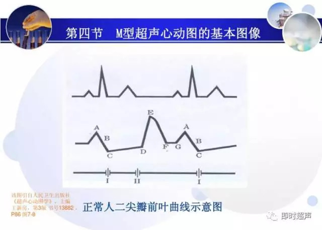 正常心脏超声诊断