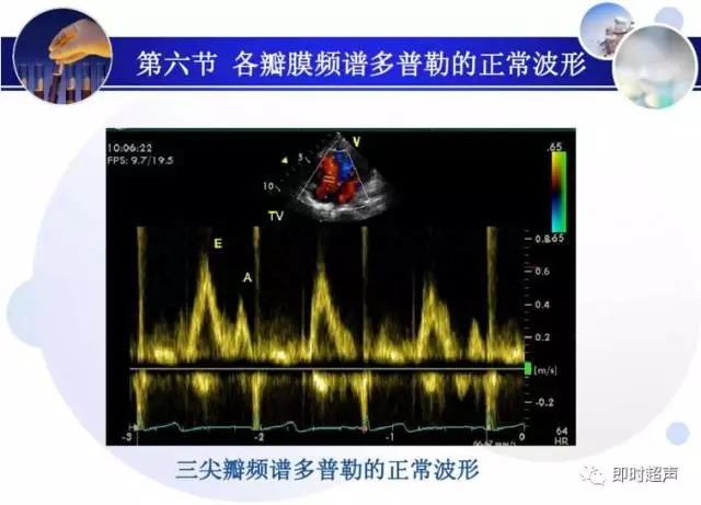 正常心脏超声诊断