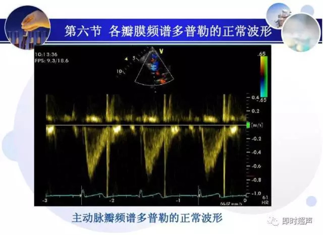 正常心脏超声诊断