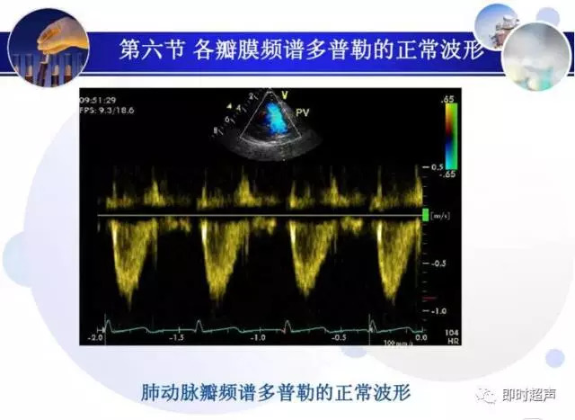 正常心脏超声诊断