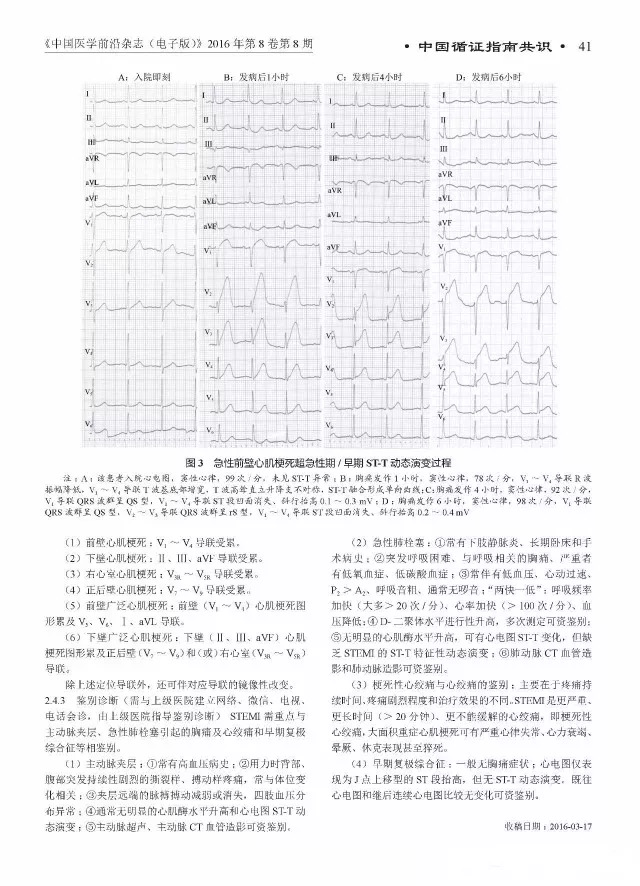 急性ST段抬高型心肌梗死溶栓治疗的合理用药指南