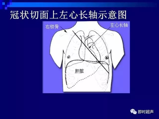 心脏超声解剖及正常声像图