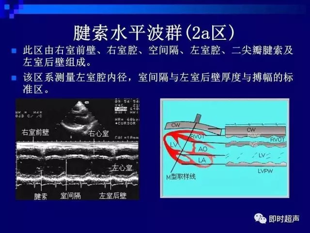 心脏超声解剖及正常声像图