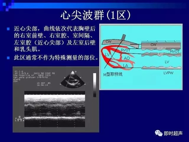 心脏超声解剖及正常声像图