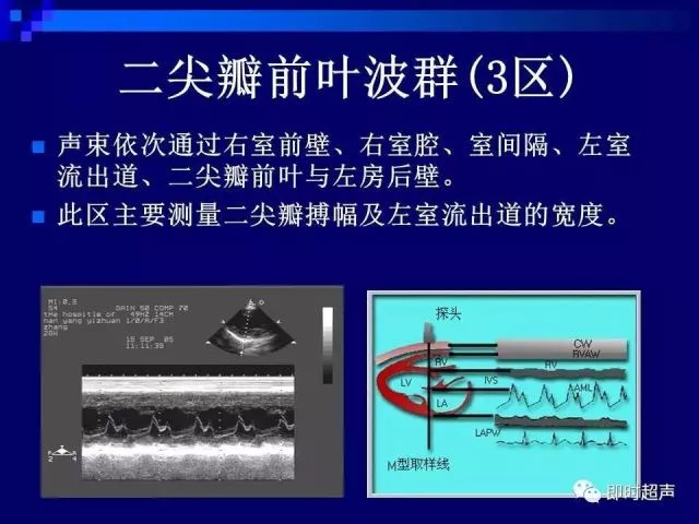 心脏超声解剖及正常声像图